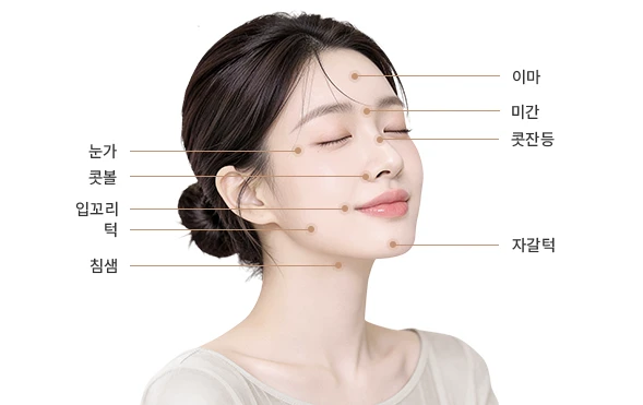 FACE 시술 부위 안내 이미지